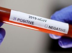 Срочно! В Молдове подтверждены два новых случая коронавируса