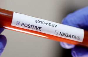 В РАЙОННОЙ БОЛЬНИЦЕ ЧАДЫР-ЛУНГИ ВСПЫШКА COVID-19