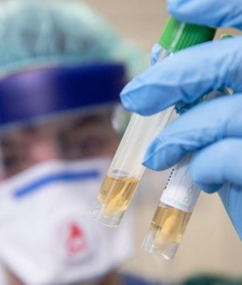 Антитела к коронавирусу нашли у пациентов, перенесших другие болезни коронавирус