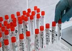 Подтверждено 195 новых случаев коронавируса