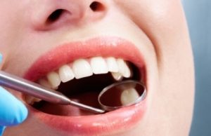 Врачи назвали самые вредные для зубов привычки