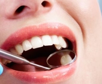 Врачи назвали самые вредные для зубов привычки