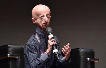 Скончался самый долгоживущий человек с синдромом преждевременного старения