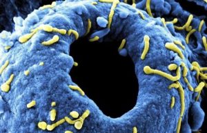 В 2024 году зафиксировано 17 вспышек опасных заболеваний, включая Marburg и H5N1