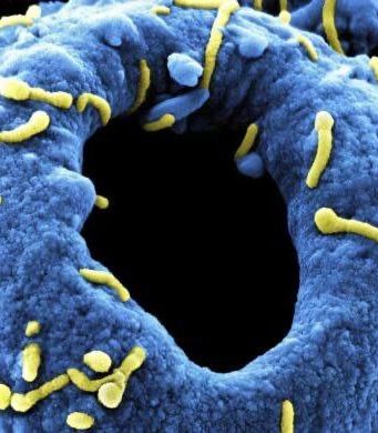 В 2024 году зафиксировано 17 вспышек опасных заболеваний, включая Marburg и H5N1