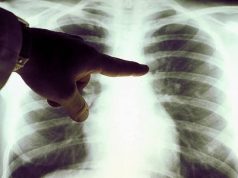 Вакцины от рака скоро начнут испытывать на россиянах