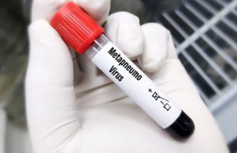В Румынии выявлен первый случай заболевания метапневмовирусом человека