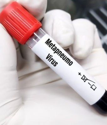 В Румынии выявлен первый случай заболевания метапневмовирусом человека