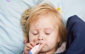 В Кишинёве вспышка кори: 4 подтверждённых случая у невакцинированных детей