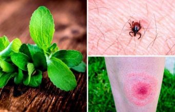 Вдвое меньше случаев болезни Лайма в Молдове за полгода