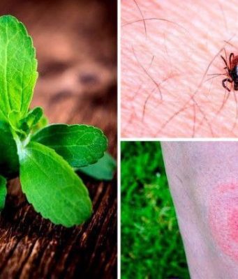 Вдвое меньше случаев болезни Лайма в Молдове за полгода