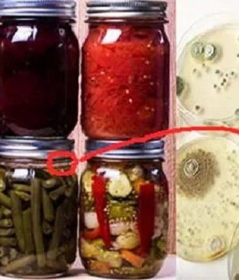 В Молдове предупреждают о рисках ботулизма при домашних заготовках