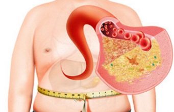 Печень под угрозой: неалкогольный жировой гепатоз и его влияние на Молдову