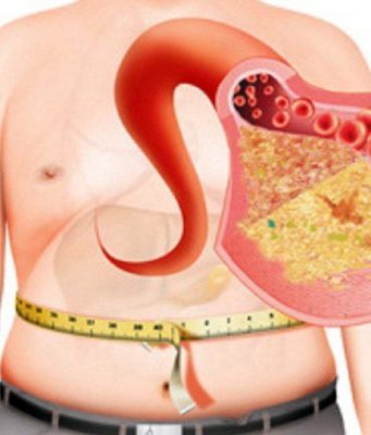 Печень под угрозой: неалкогольный жировой гепатоз и его влияние на Молдову