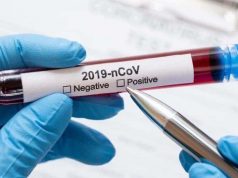 За неделю в Молдове зарегистрировано 855 случаев COVID-19