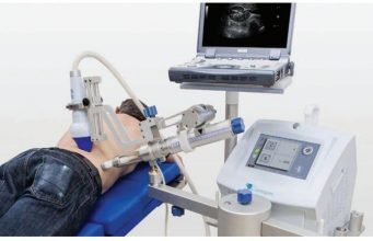 Крупнейший провайдер диализа в Молдове куплен инвестгруппой из Дубая