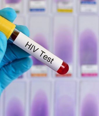 В Молдове зафиксировано почти 900 новых случаев ВИЧ