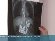 В Бендерах 7-летний мальчик проглотил 52 магнитные палочки из конструктора