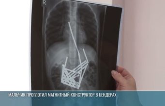 В Бендерах 7-летний мальчик проглотил 52 магнитные палочки из конструктора